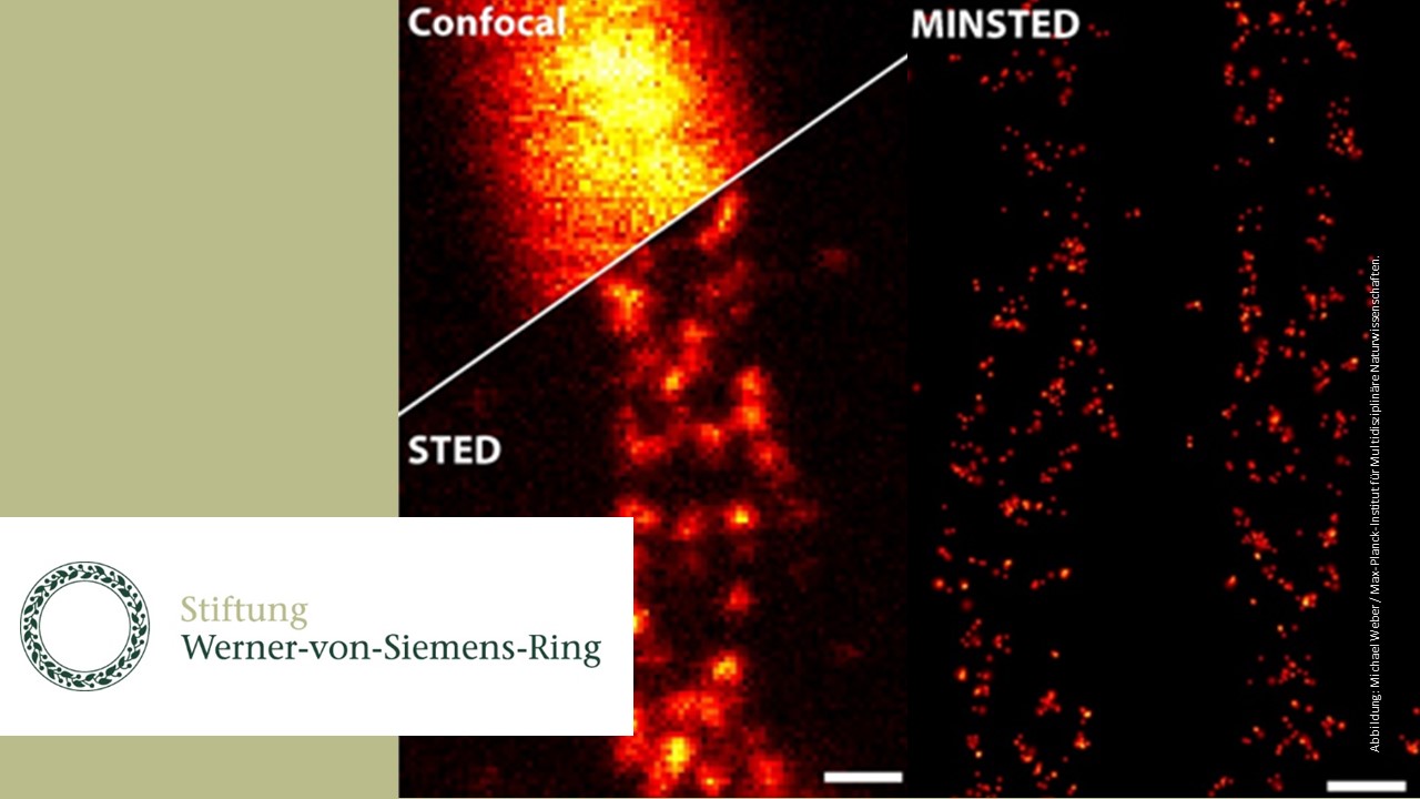 Auflösungsvermögen verschiedener Lichtmikroskopie-Techniken: STED (unten links) verbessert die Detailschärfe drastisch im Vergleich zur konventionellen konfokalen Mikroskopie (oben links). MINSTED (rechts) erreicht eine noch zehnmal höhere Auflösung. Dargestellt sind fluoreszenzmarkierte Proteine (Mic60) in den Mitochondrien einer Zelle. (Proben von Stefan Stoldt und Stefan Jakobs, MPI für Multidisziplinäre Naturwissenschaften). Der Maßstabsbalken entspricht 100 Nanometern. Abbildung: Michael Weber / Max-Planck-Institut für Multidisziplinäre Naturwissenschaften.